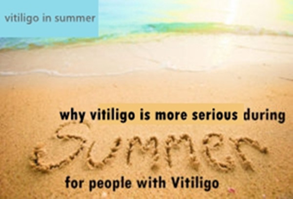 summer vitiligo.jpg